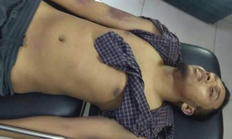 আবরারকে পিটিয়ে হত্যা করা হয়েছে ময়নাতদন্ত শেষে চিকিৎসকরা