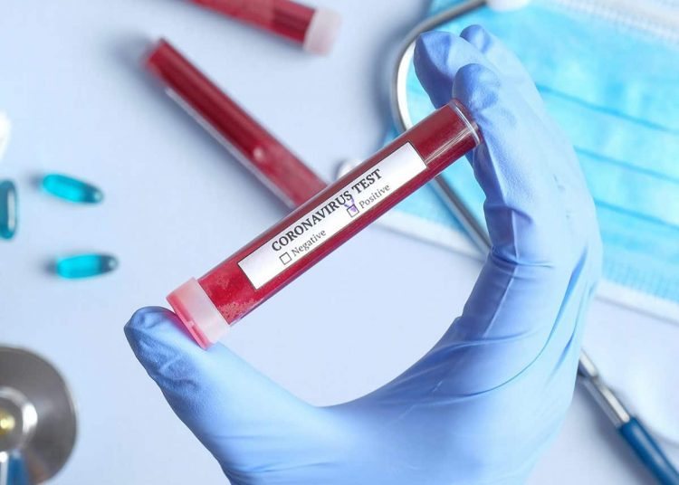 করোনাভাইরাস